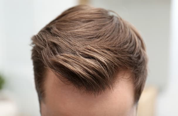 Prótesis capilares para hombres